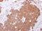 Activin A Receptor Type 1B antibody, GTX102873, GeneTex, Immunohistochemistry paraffin image 