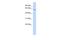 Transmembrane Protein 209 antibody, A15080, Boster Biological Technology, Western Blot image 