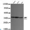 Protein Phosphatase 1 Catalytic Subunit Alpha antibody, LS-C813094, Lifespan Biosciences, Western Blot image 