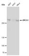 BRCA1 DNA Repair Associated antibody, NBP1-41185, Novus Biologicals, Chromatin Immunoprecipitation image 
