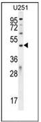 Phosphoinositide-binding protein PIP3-E antibody, AP52142PU-N, Origene, Western Blot image 