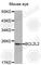 BCL2L2-PABPN1 Readthrough antibody, A1158, ABclonal Technology, Western Blot image 