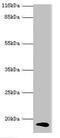 Calmodulin Like 5 antibody, CSB-PA873713HA01HU, Cusabio, Western Blot image 