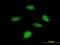Damage Specific DNA Binding Protein 2 antibody, orb378027, Biorbyt, Immunofluorescence image 