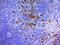 TNF Receptor Superfamily Member 8 antibody, NBP2-48314, Novus Biologicals, Immunohistochemistry paraffin image 