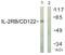 Interleukin 2 Receptor Subunit Beta antibody, LS-B7003, Lifespan Biosciences, Western Blot image 