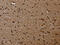 FLNA antibody, CSB-PA904028, Cusabio, Immunohistochemistry paraffin image 