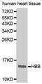 Hemoglobin Subunit Beta antibody, MBS127849, MyBioSource, Western Blot image 
