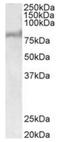 ATP Binding Cassette Subfamily D Member 2 antibody, orb12309, Biorbyt, Western Blot image 