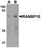 RAN Binding Protein 10 antibody, A09936, Boster Biological Technology, Western Blot image 