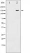 c-met antibody, abx011906, Abbexa, Western Blot image 