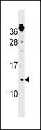 Cyclin-dependent kinases regulatory subunit 1 antibody, LS-C159356, Lifespan Biosciences, Western Blot image 