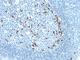 Immunoglobulin Kappa Variable 1D-16 antibody, NBP2-45086, Novus Biologicals, Immunohistochemistry frozen image 