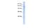 Interphotoreceptor Matrix Proteoglycan 2 antibody, PA5-69455, Invitrogen Antibodies, Western Blot image 