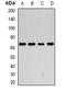 Solute Carrier Family 3 Member 2 antibody, orb382043, Biorbyt, Western Blot image 