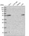 Carbohydrate Sulfotransferase 3 antibody, NBP2-57128, Novus Biologicals, Western Blot image 