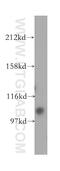 Up-regulator of cell proliferation antibody, 11998-1-AP, Proteintech Group, Western Blot image 