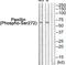 Paxillin antibody, abx012639, Abbexa, Western Blot image 