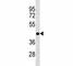 Adenosine Deaminase antibody, F53704-0.1ML, NSJ Bioreagents, Western Blot image 