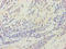 Histidyl-TRNA Synthetase 2, Mitochondrial antibody, A54592-100, Epigentek, Immunohistochemistry paraffin image 