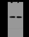 Nudix Hydrolase 18 antibody, 204583-T32, Sino Biological, Western Blot image 