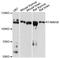 RHO Family Interacting Cell Polarization Regulator 2 antibody, A9234, ABclonal Technology, Western Blot image 