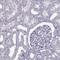 Acid Sensing Ion Channel Subunit 2 antibody, PA5-62554, Invitrogen Antibodies, Immunohistochemistry paraffin image 