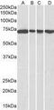 DEAD-Box Helicase 5 antibody, GTX10261, GeneTex, Western Blot image 