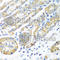 Methionine Sulfoxide Reductase B2 antibody, A8364, ABclonal Technology, Immunohistochemistry paraffin image 