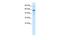 RUN And FYVE Domain Containing 3 antibody, PA5-40867, Invitrogen Antibodies, Western Blot image 