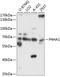 Prolyl 4-Hydroxylase Subunit Alpha 1 antibody, A05917, Boster Biological Technology, Western Blot image 