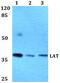 Linker For Activation Of T Cells antibody, PA5-75190, Invitrogen Antibodies, Western Blot image 