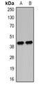 Insulin Like Growth Factor Binding Protein 4 antibody, orb378123, Biorbyt, Western Blot image 