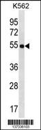 Lymphocyte Transmembrane Adaptor 1 antibody, 60-025, ProSci, Western Blot image 