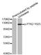 Protein Tyrosine Kinase 2 antibody, STJ22356, St John
