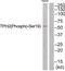 Tryptophan Hydroxylase 2 antibody, 79-937, ProSci, Western Blot image 