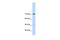 GTF2I Repeat Domain Containing 1 antibody, PA5-40769, Invitrogen Antibodies, Western Blot image 