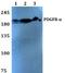 Platelet Derived Growth Factor Receptor Alpha antibody, A00366S1057, Boster Biological Technology, Western Blot image 