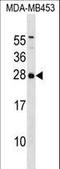 Inosine Triphosphatase antibody, LS-C159945, Lifespan Biosciences, Western Blot image 