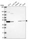 N-Terminal EF-Hand Calcium Binding Protein 3 antibody, HPA071786, Atlas Antibodies, Western Blot image 