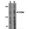 Rho Guanine Nucleotide Exchange Factor 17 antibody, MBS151033, MyBioSource, Western Blot image 