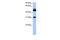 Cylicin 2 antibody, GTX45492, GeneTex, Western Blot image 