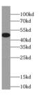 Odr-4 GPCR Localization Factor Homolog antibody, FNab01064, FineTest, Western Blot image 