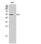 Checkpoint Kinase 1 antibody, STJ92267, St John