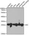 Adenylate Kinase 4 antibody, GTX65835, GeneTex, Western Blot image 