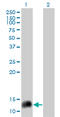 Neuropeptide Y antibody, LS-B6388, Lifespan Biosciences, Western Blot image 