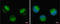Mitogen-Activated Protein Kinase Kinase Kinase 14 antibody, GTX109419, GeneTex, Immunofluorescence image 