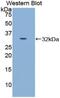 Cadherin 16 antibody, MBS2026681, MyBioSource, Western Blot image 