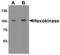 Hexokinase 1 antibody, LS-B13086, Lifespan Biosciences, Western Blot image 