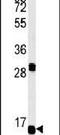 Histone Cluster 1 H1 Family Member B antibody, PA5-25155, Invitrogen Antibodies, Western Blot image 